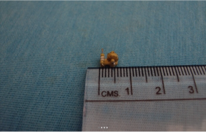 SMALLEST WHEEL